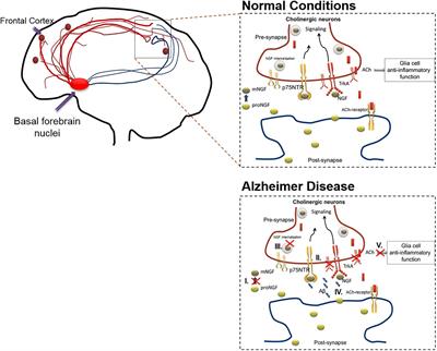 Frontiers | Innovative Therapy For Alzheimer’s Disease-With Focus On ...